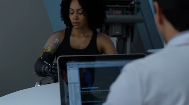 Misty gets her bionic arm